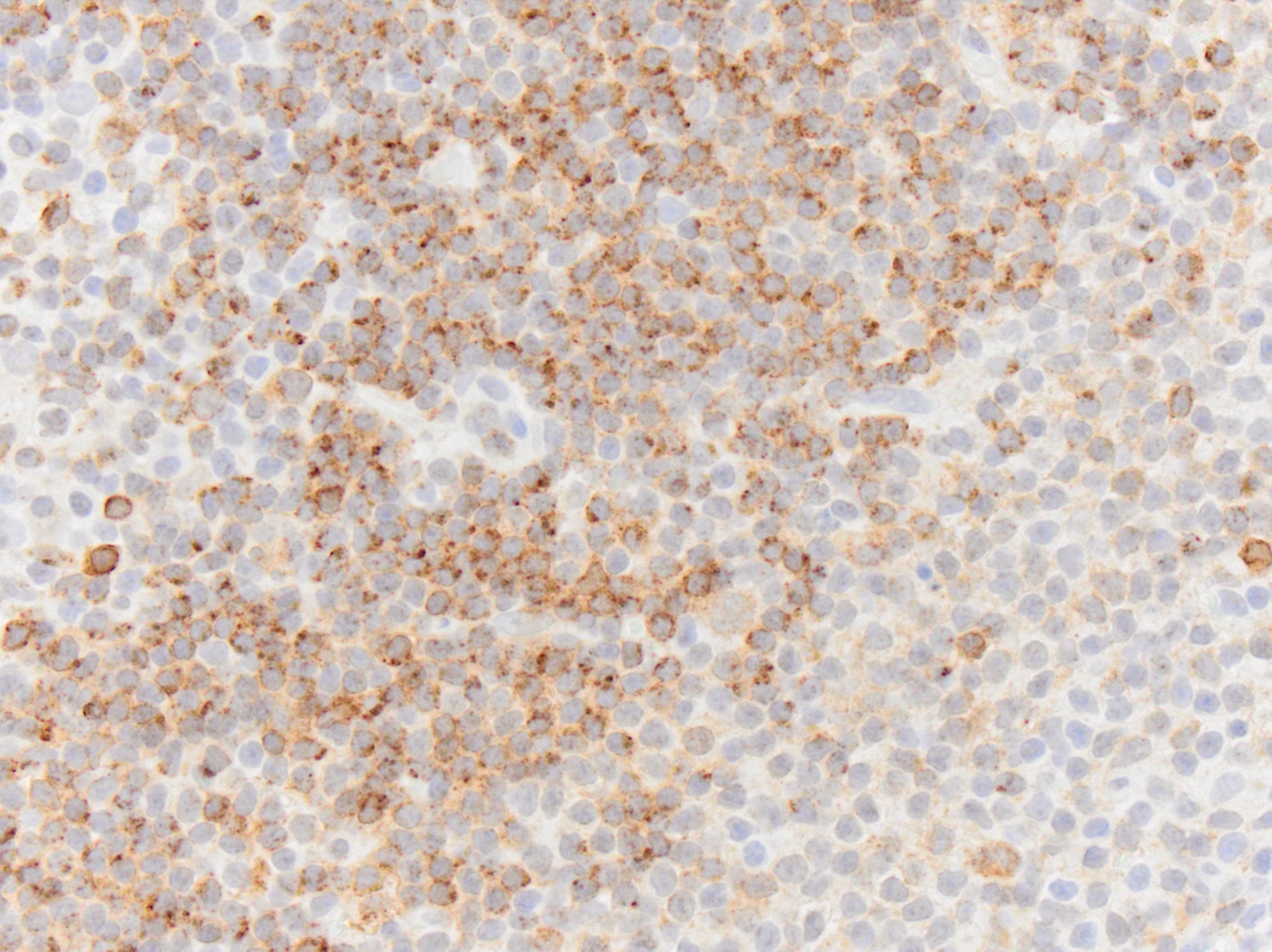 CD79A Antibody (HM57) - BSA Free NB100-64347